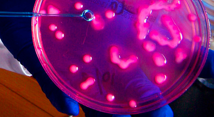 An image of Carbapenem-resistant Enterobacteriaceae, also known as CRE. (Credit: CDC)