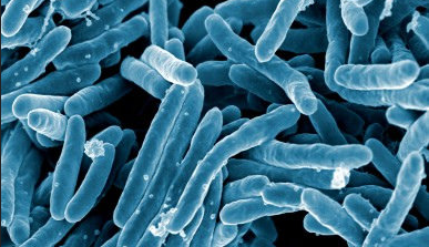 A scanning electron micrograph of Mycobacterium tuberculosis bacteria, which cause tuberculosis, is pictured. (Credit: NIAID / Flickr via Creative Commons)