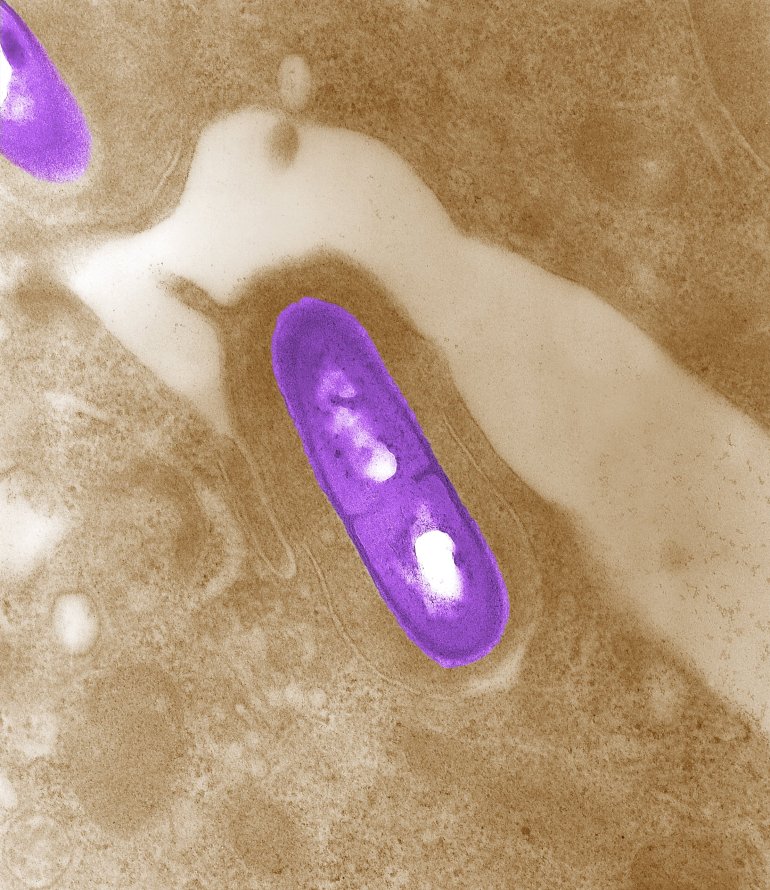 Listeria is shown in a file photo.