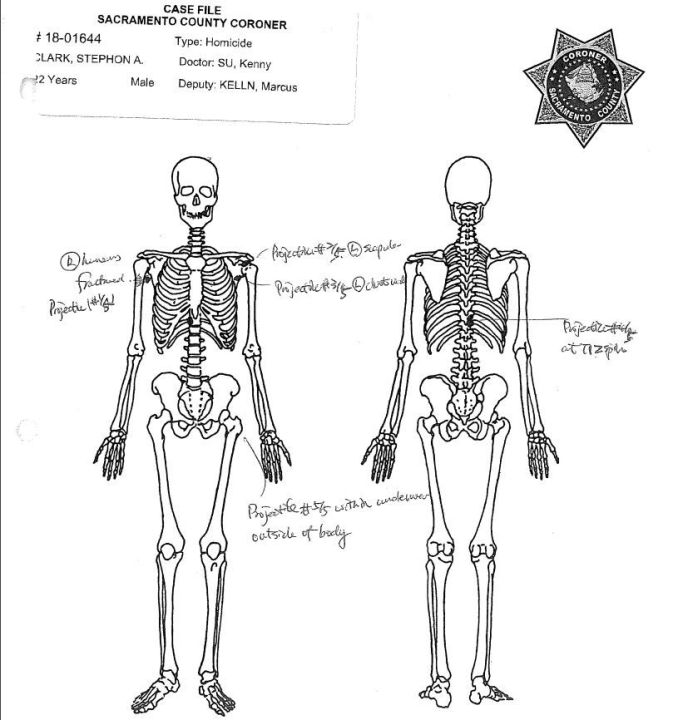 A skeletal view shows a fracture to the right humerus, perforation of the left scapula and fractures to Stephon Clark's ribs and spine in images from the Sacramento County Coroner's report released May 1, 2018.