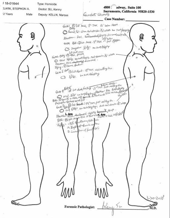 Gunshot wounds to Stephon Clark's arm and neck are seen in this lateral view image from the Sacramento County Coroner's report released May 1, 2018.