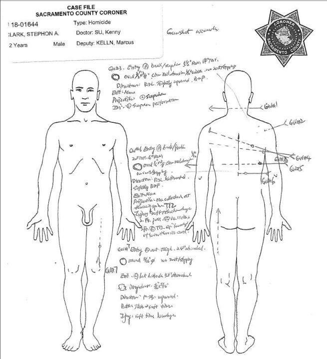 Gunshot wounds to Stephon Clark's back, left thigh, arm, neck and chest are shown in images from the Sacramento County Coroner's report released May 1, 2018.