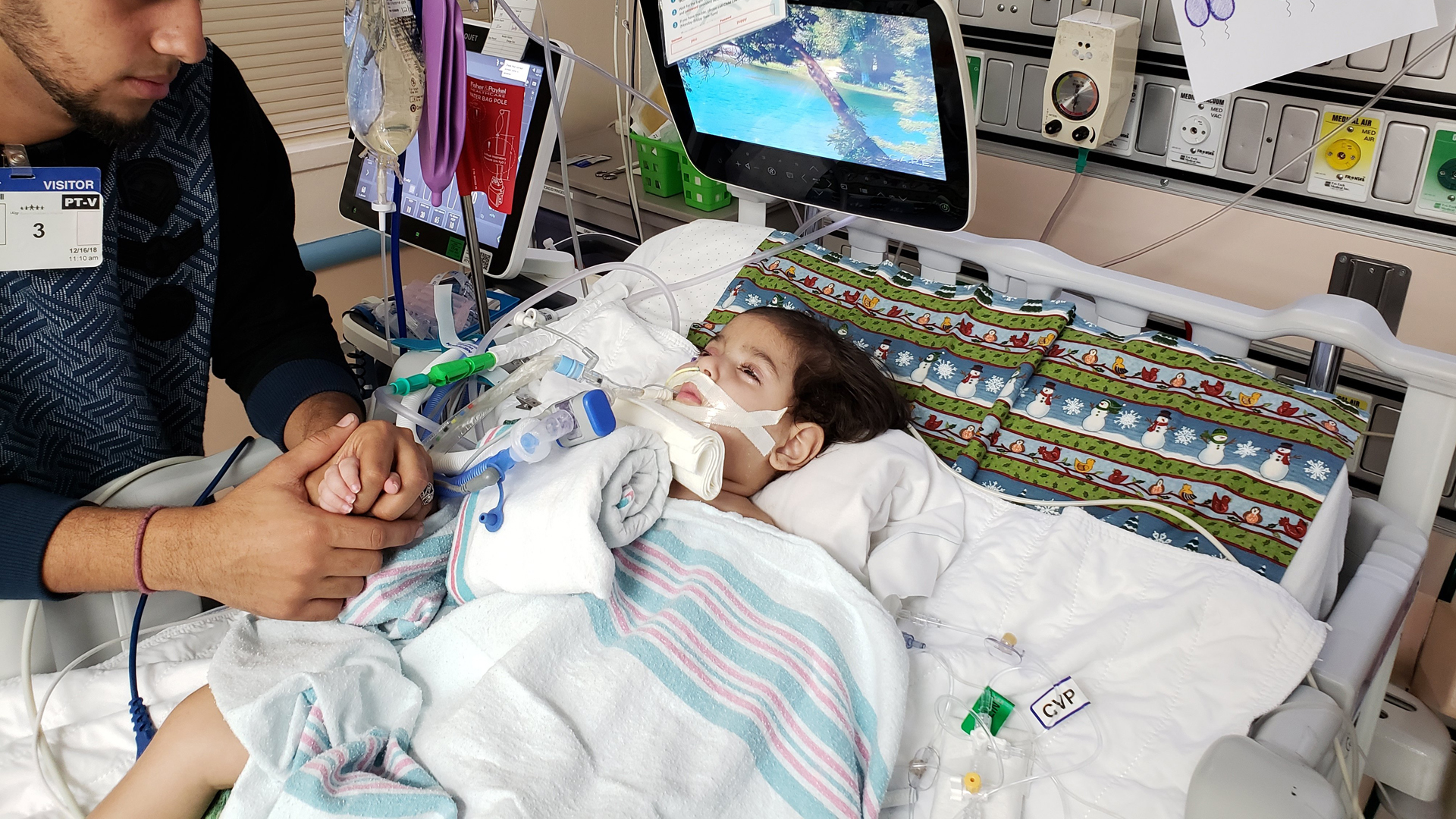 Abdullah Hassan, 2, is at UCSF Benioff Children's Hospital in Oakland due to a worsening genetic brain condition. (Credit: CAIR - Sacramento Valley)