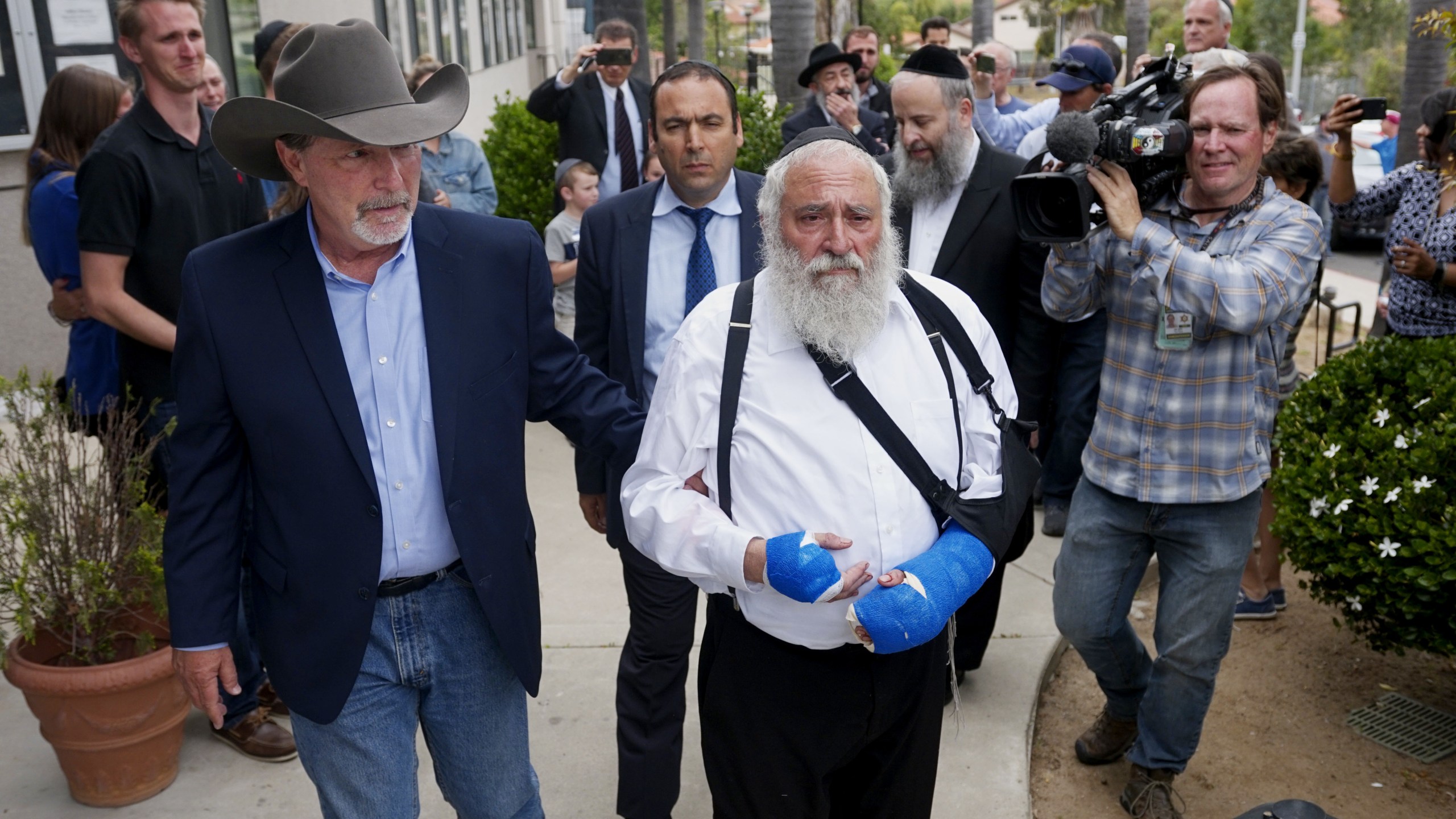 Executive Director Rabbi Ysrael Goldstein, who was shot in the hands, walks towards a press conference with Poway Mayor Steve Vaus outside of the Chabad of Poway Synagogue on April 28, 2019, in Poway, Calif. (Credit: SANDY HUFFAKER/AFP/Getty Images)