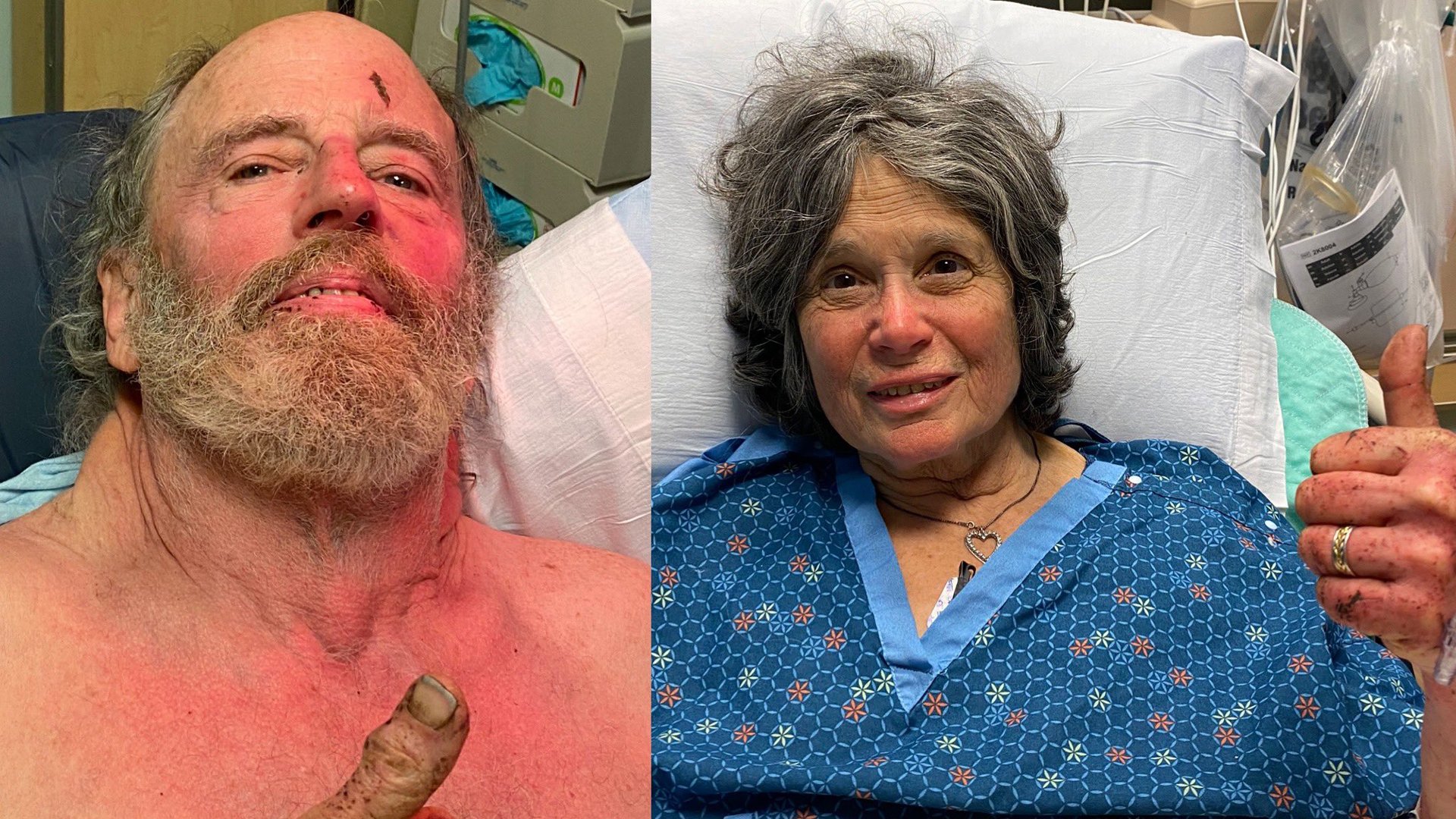 Ian Irwin, 72, left, and Carol Kiparsky, 77, of Palo Alto, pictured after their rescue after a week lost in a forest in Marin County on Feb. 22, 2020. (Credit: Marin County Sheriff's Office)