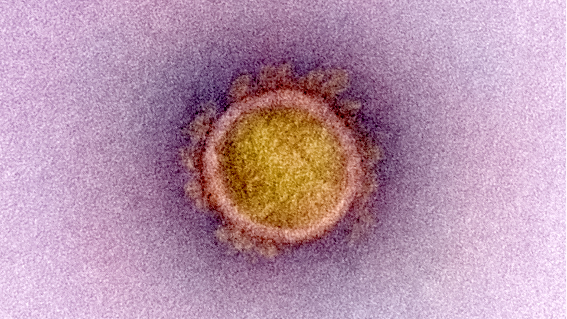 A coronavirus particle isolated from a patient is seen in a micrograph image captured and color-enhanced at a NIAID facility in Fort Detrick, Maryland. (NIAID)