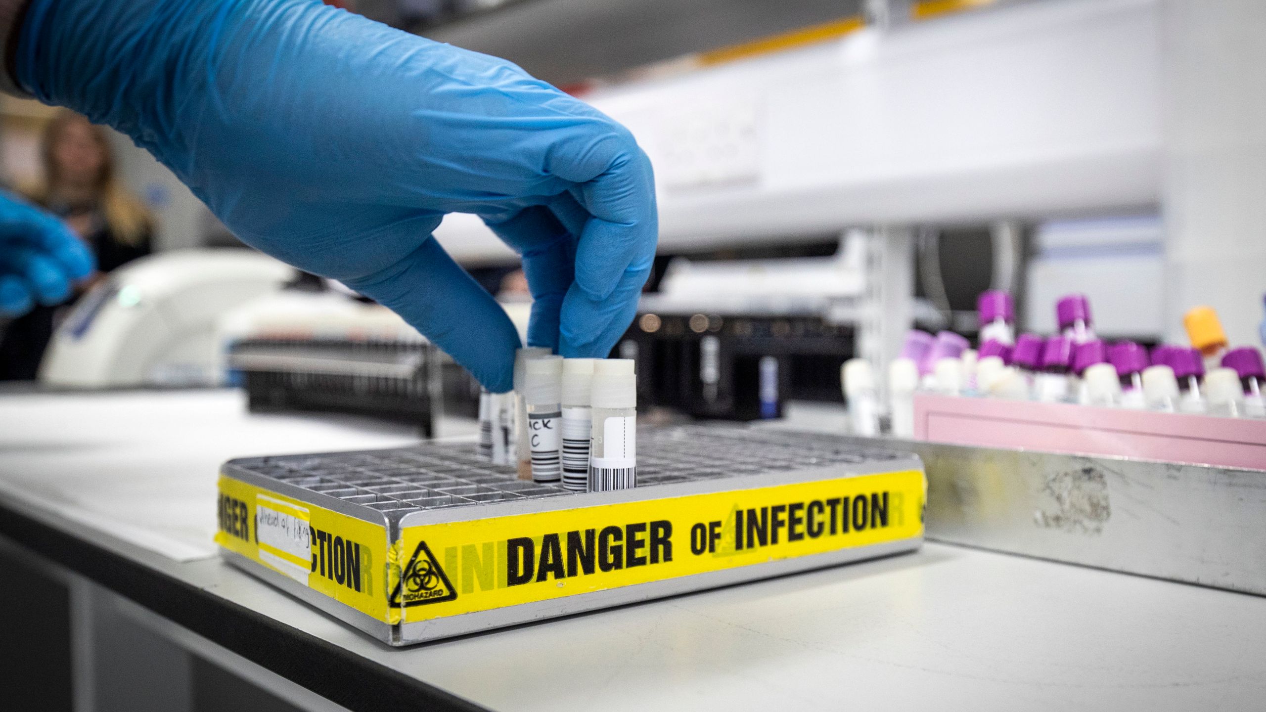 A clinical technician extracts samples so that the genetic structure of a virus can be analyzed in the coronavirus testing laboratory at Glasgow Royal Infirmary in Scotland on Feb. 19, 2020. (Credit: Jane Barlow / Getty Images)