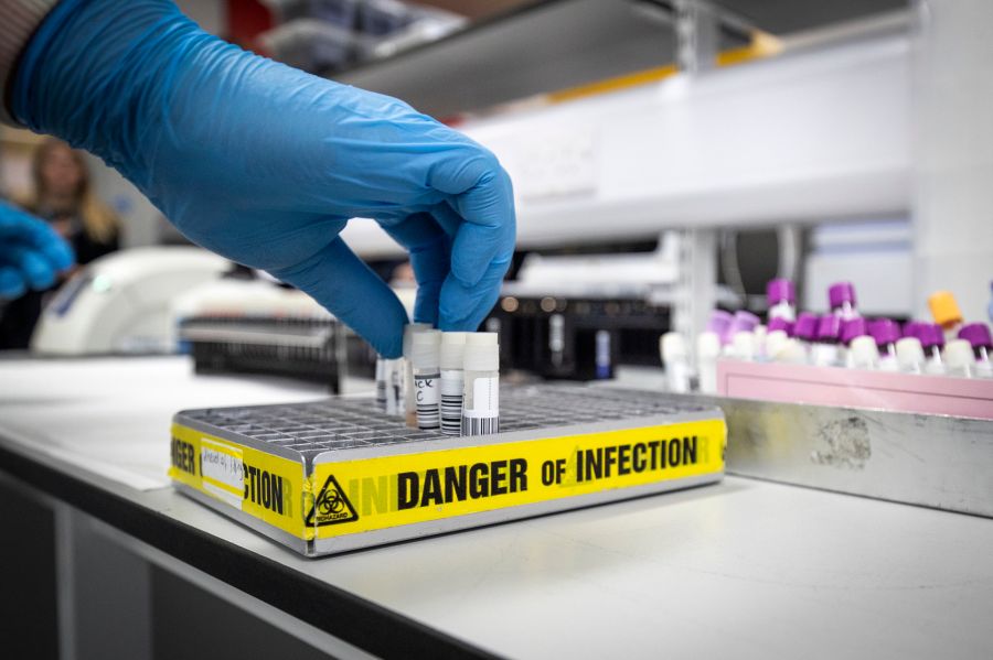 A clinical technician extracts samples so that the genetic structure of a virus can be analyzed in the coronavirus testing laboratory at Glasgow Royal Infirmary in Scotland on Feb. 19, 2020. (Credit: Jane Barlow / Getty Images)