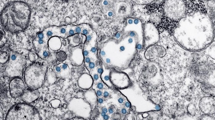 An undated microscopic image of the COVID-19 virus, provided by the U.S. Centers for Disease Control and Prevention.