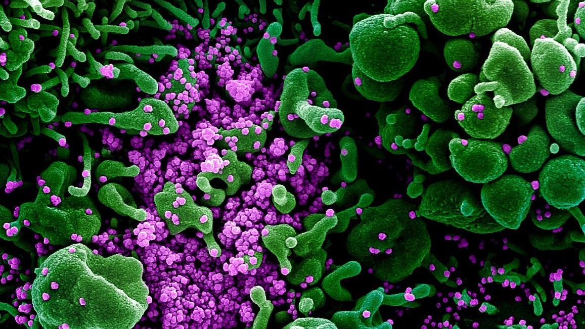 The coronavirus known as SARS-CoV-2, shown in purple, infects a cell, colored in green. (National Institute of Allergy and Infectious Diseases)