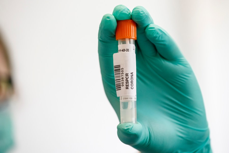 An employee wearing a protective mask and gloves shows a throat swab sample for Covid-19 testing at the Labor Dr. Heidrich & Kollegen MVZ GmbH medical lab on April 16, 2020, in Hamburg, Germany. (Morris MacMatzen/Getty Images)