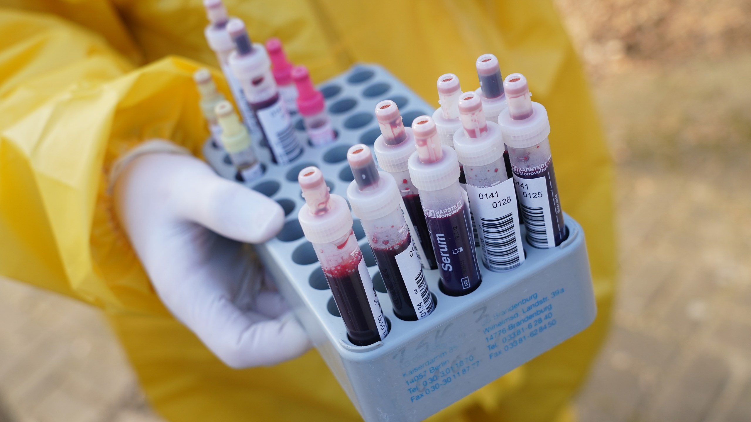 A medical volunteer in a protective suit holds vials of blood samples taken from patients being tested for the coronavirus on March 27, 2020, in Berlin, Germany.(Sean Gallup/Getty Images)