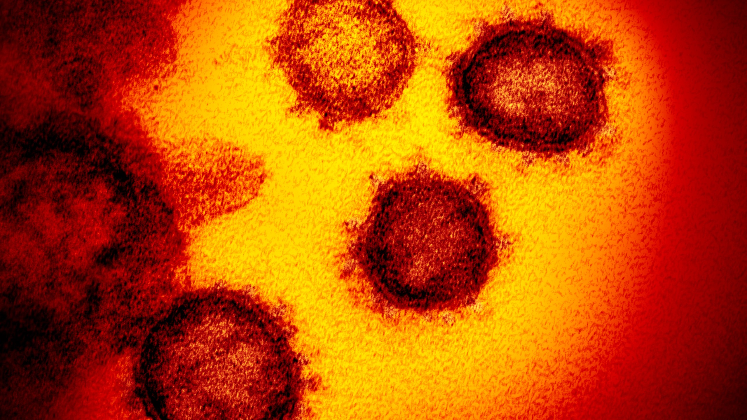 This undated electron microscope image made available by the U.S. National Institutes of Health in February 2020 shows the Novel Coronavirus SARS-CoV-2. (NIAID-RML via AP)