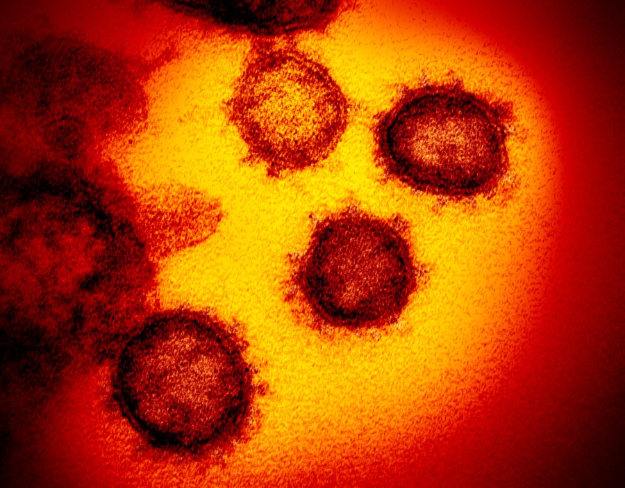 This undated electron microscope image made available by the U.S. National Institutes of Health in February 2020 shows the Novel Coronavirus SARS-CoV-2. (NIAID-RML via AP)