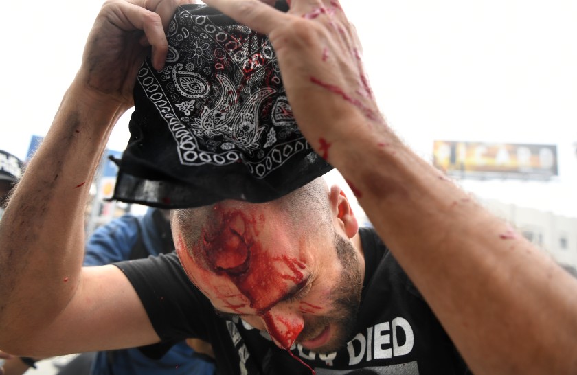 A protester runs for safety after being shot with a foam round by LAPD officers at 3rd Street and Fairfax Avenue in Los Angeles on Saturday. (Wally Skalij / Los Angeles Times)