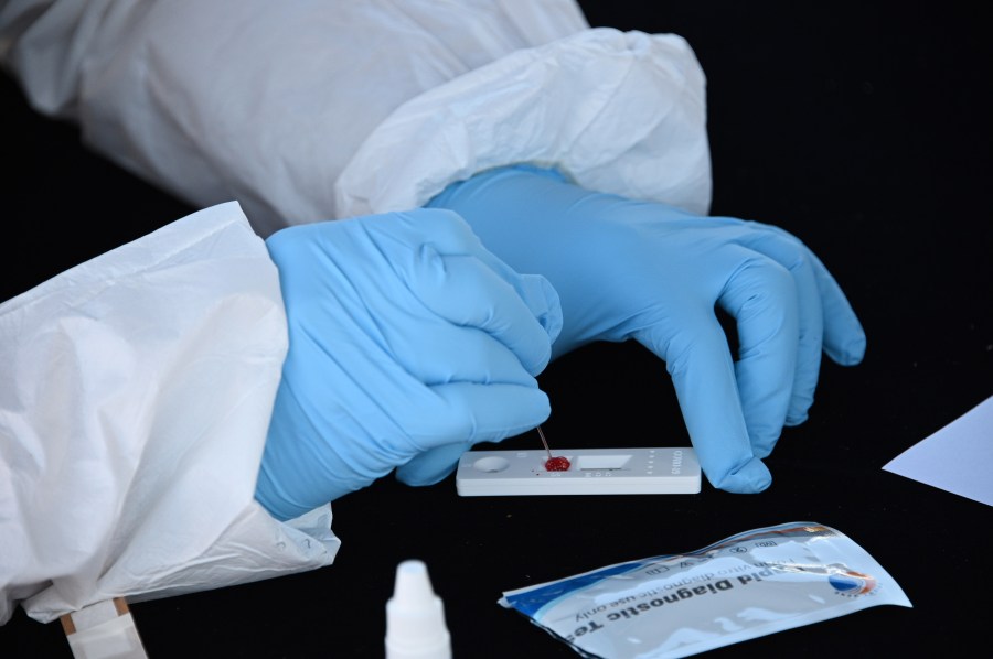 A blood sample is processed at a rapid serological testing site in San Dimas on July 26, 2020. (Robyn Beck / AFP / Getty Images)