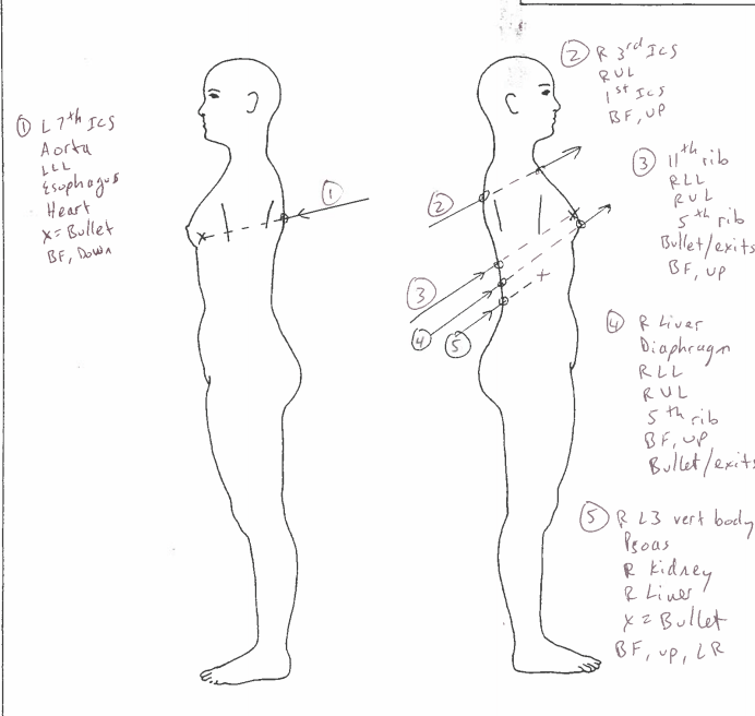 Diagrams showing gunshot wounds suffered by Andres Guardado. (Los Angeles County Department of Medical Examiner-Coroner)