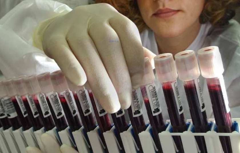 Scientists are finding evidence that blood type may be a risk factor for COVID-19. In one study, people with Type A blood were more likely to be hospitalized for the disease, while people with Type O blood were less likely to have severe COVID-19. (Don Bartletti / Los Angeles Times)