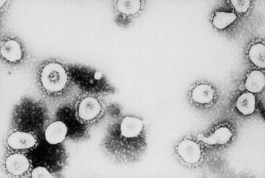 This photo from the Centers for Disease Control and Prevention (CDC) shows a microscopic view of the Coronavirus at the CDC in Atlanta, Georgia. (Getty Images)