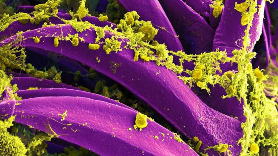 Purple-colored Yersinia pestis bacteria, the bacteria that causes the plague, seen on the spines of a flea. (National Institute of Allergy and Infectious Diseases via CNN Wire)