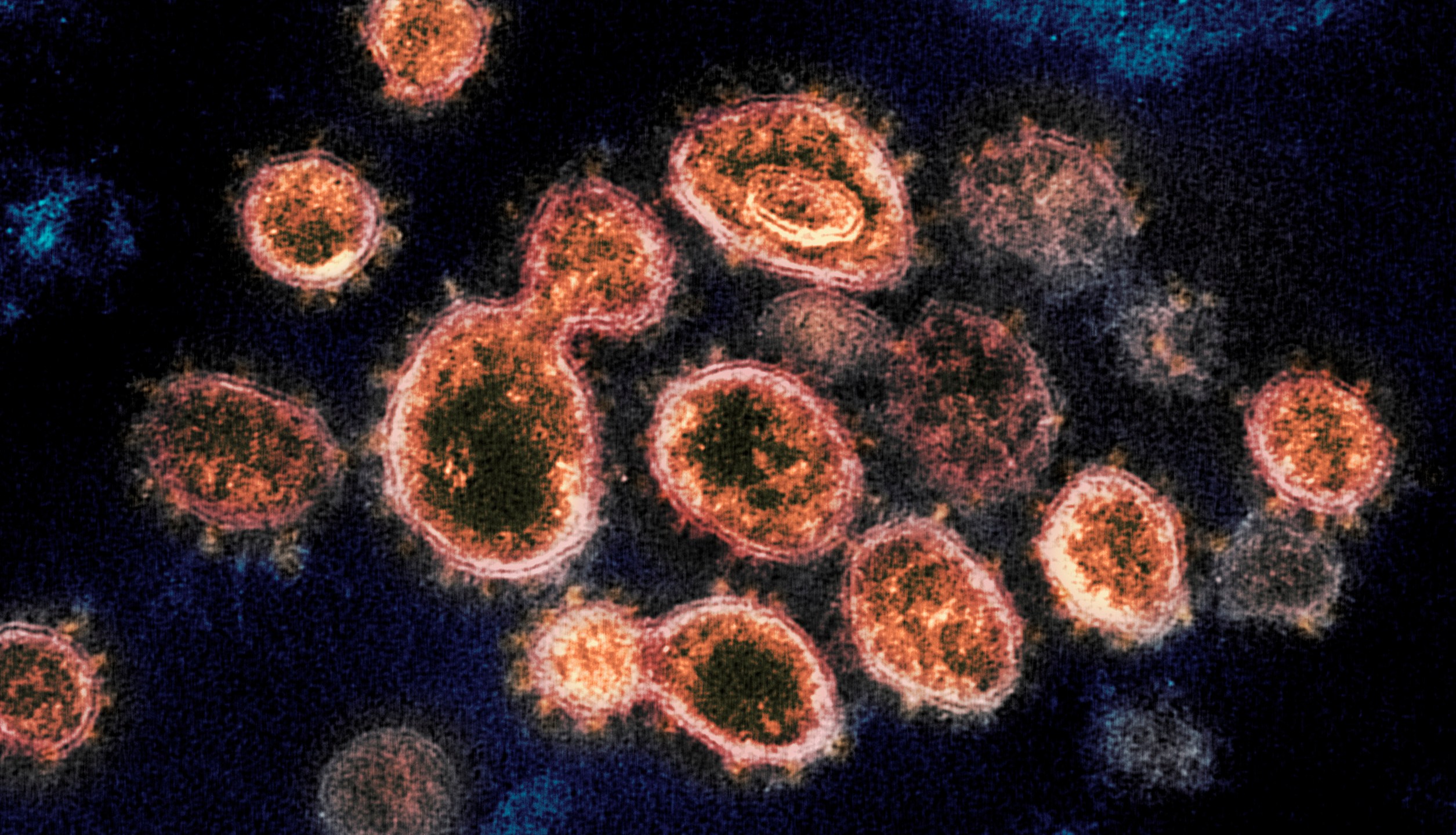 This 2020 electron microscope image provided by the National Institute of Allergy and Infectious Diseases - Rocky Mountain Laboratories shows SARS-CoV-2 virus particles which causes COVID-19, isolated from a patient in the U.S., emerging from the surface of cells cultured in a lab. On Monday, Oct. 5, 2020, the top U.S. public health agency said that coronavirus can spread greater distances through the air than 6 feet, particularly in poorly ventilated and enclosed spaces. But agency officials continued to say such spread is uncommon, and current social distancing guidelines still make sense. (NIAID-RML via AP)