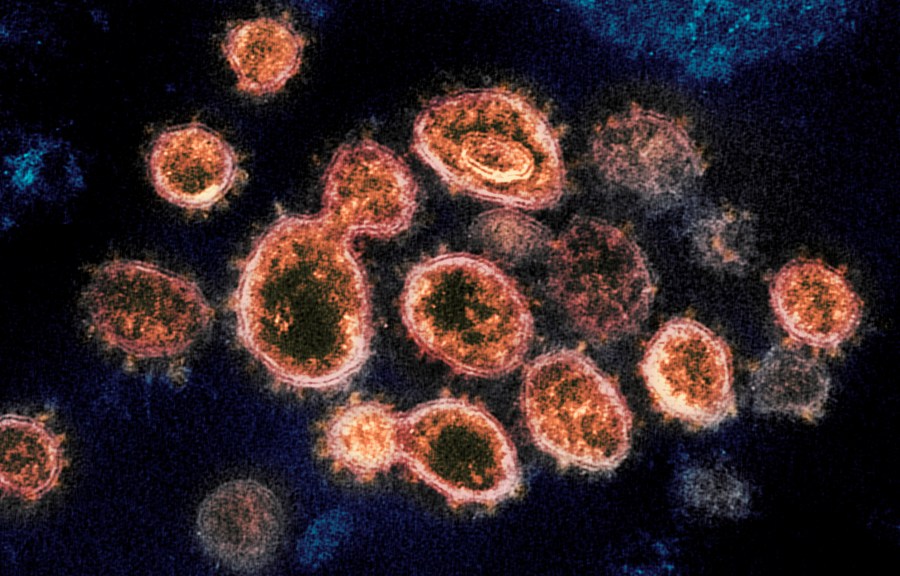 This 2020 electron microscope image provided by the National Institute of Allergy and Infectious Diseases - Rocky Mountain Laboratories shows SARS-CoV-2 virus particles which causes COVID-19, isolated from a patient in the U.S., emerging from the surface of cells cultured in a lab. On Monday, Oct. 5, 2020, the top U.S. public health agency said that coronavirus can spread greater distances through the air than 6 feet, particularly in poorly ventilated and enclosed spaces. But agency officials continued to say such spread is uncommon, and current social distancing guidelines still make sense. (NIAID-RML via AP)