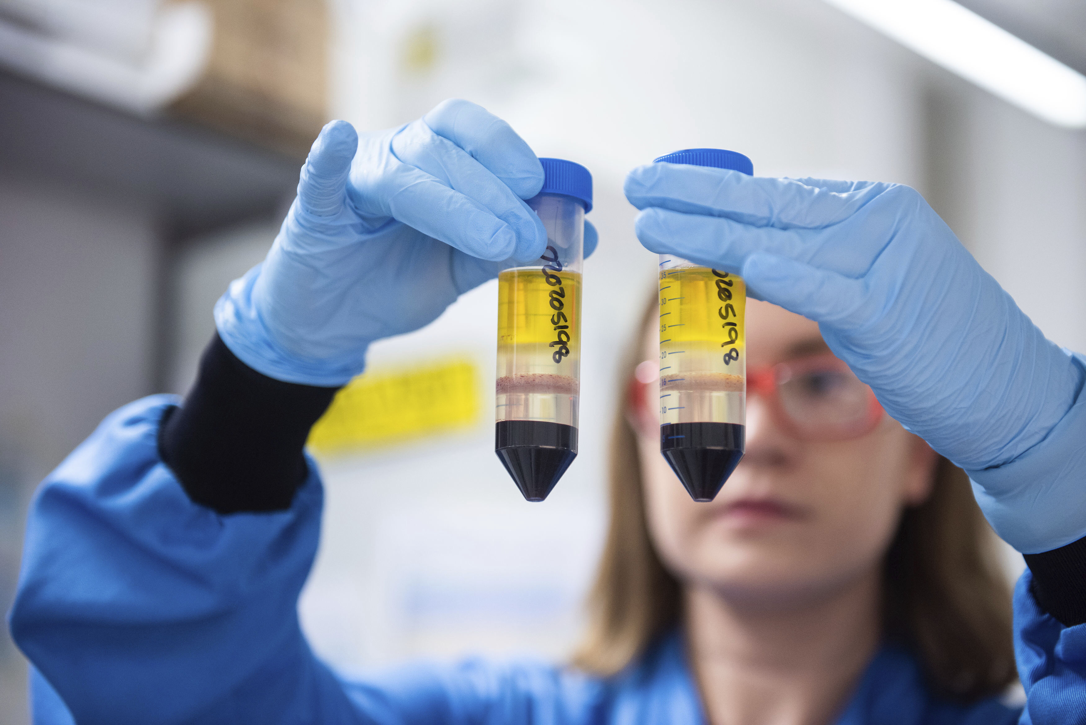 In this undated file photo issued by the University of Oxford on Nov. 23, 2020, a researcher in a laboratory at the Jenner Institute in Oxford, England, works on the coronavirus vaccine developed by AstraZeneca and Oxford University. (University of Oxford / John Cairns via Associated Press)