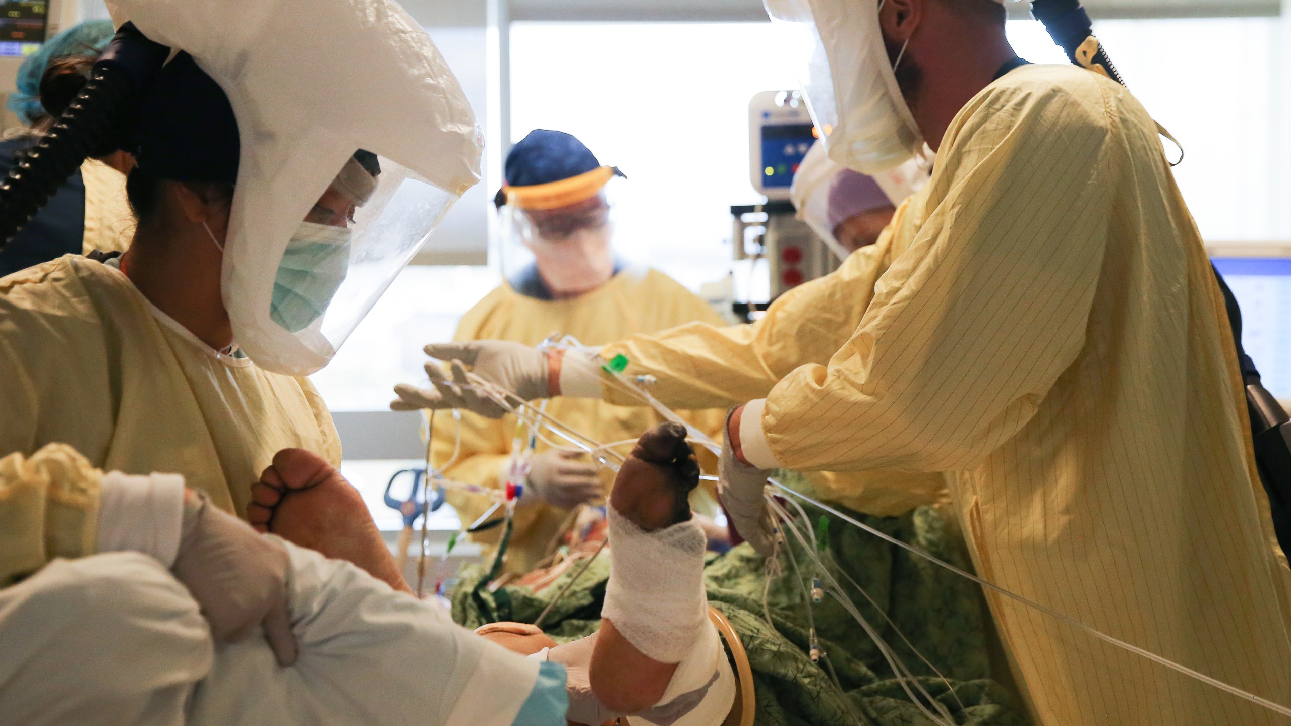 Clinicians work after manually proning a COVID-19 patient in the intensive care unit at Sharp Grossmont Hospital on Dec.14, 2020 in La Mesa, California. (Mario Tama/Getty Images)