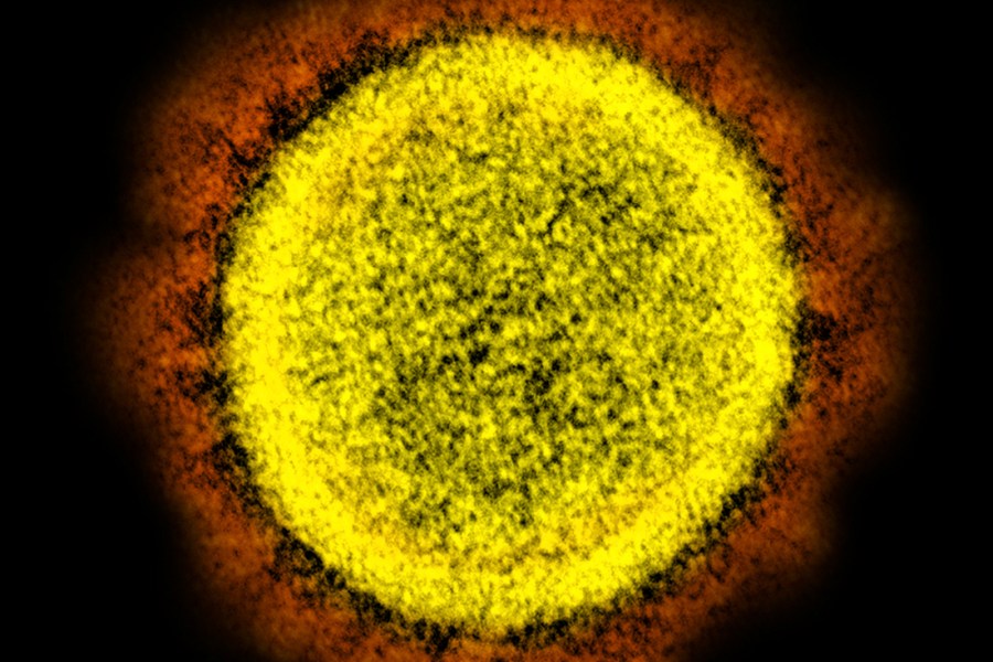 This 2020 electron microscope image made available by the National Institute of Allergy and Infectious Diseases shows a Novel Coronavirus SARS-CoV-2 particle isolated from a patient, in a laboratory in Fort Detrick, Md. Coronaviruses, including the newest one, are named for the spikes that cover their outer surface like a crown, or corona in Latin. Using those club-shaped spikes, the virus latches on to the outer wall of a human cell, invades it and replicates, creating viruses to hijack more cells. (NIAID/NIH via AP)