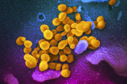 This undated electron microscope image made available by the U.S. National Institutes of Health in February 2020 shows the Novel Coronavirus SARS-CoV-2, yellow, emerging from the surface of cells, blue/pink, cultured in the lab. (NIAID-RML via AP, File)