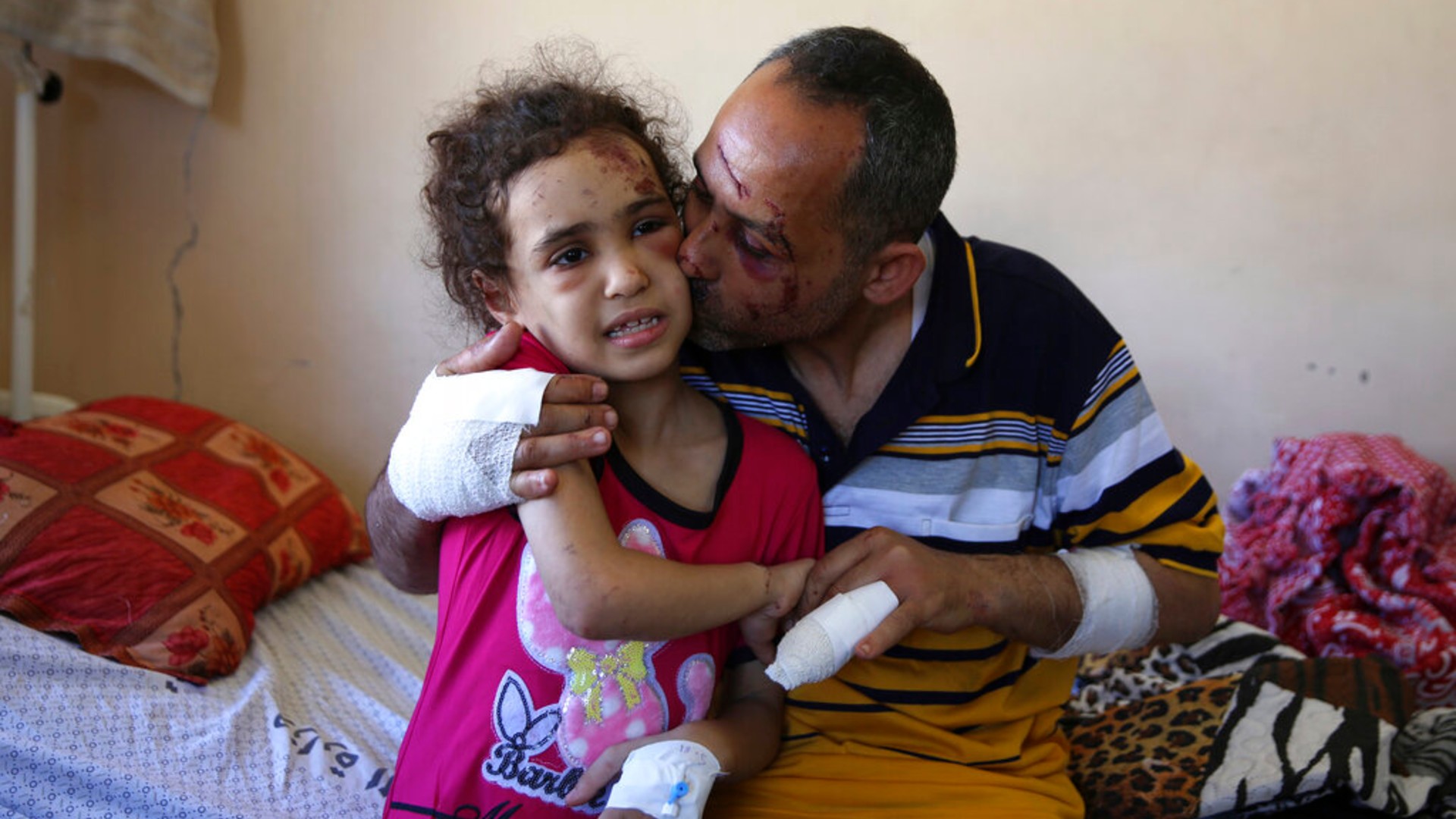 Suzy Ishkontana, 7, is kissed by her father Riad Ishkontana, 42, at Shifa Hospital in Gaza City, Tuesday, May 18, 2021. (AP Photo/Abdel Kareem Hana)