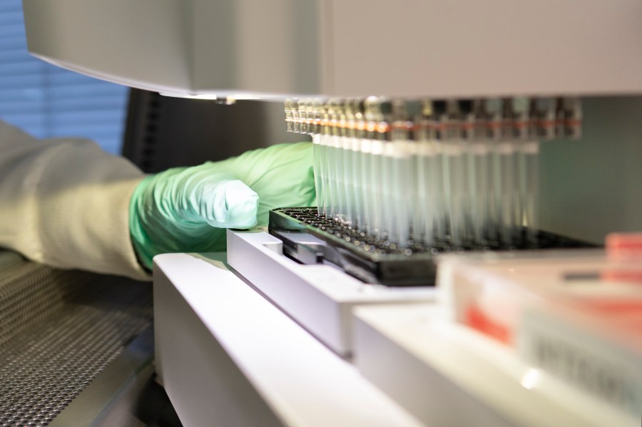 In this 2019 photo provided by Biogen, a researcher works on the development of the medication aducanumab in Cambridge, Mass. On Monday, June 7, 2021, the Food and Drug Administration approved aducanumab, the first new drug for Alzheimer’s disease in nearly 20 years, disregarding warnings from independent advisers that the much-debated treatment hasn’t been shown to help slow the brain-destroying disease. (Biogen via AP)