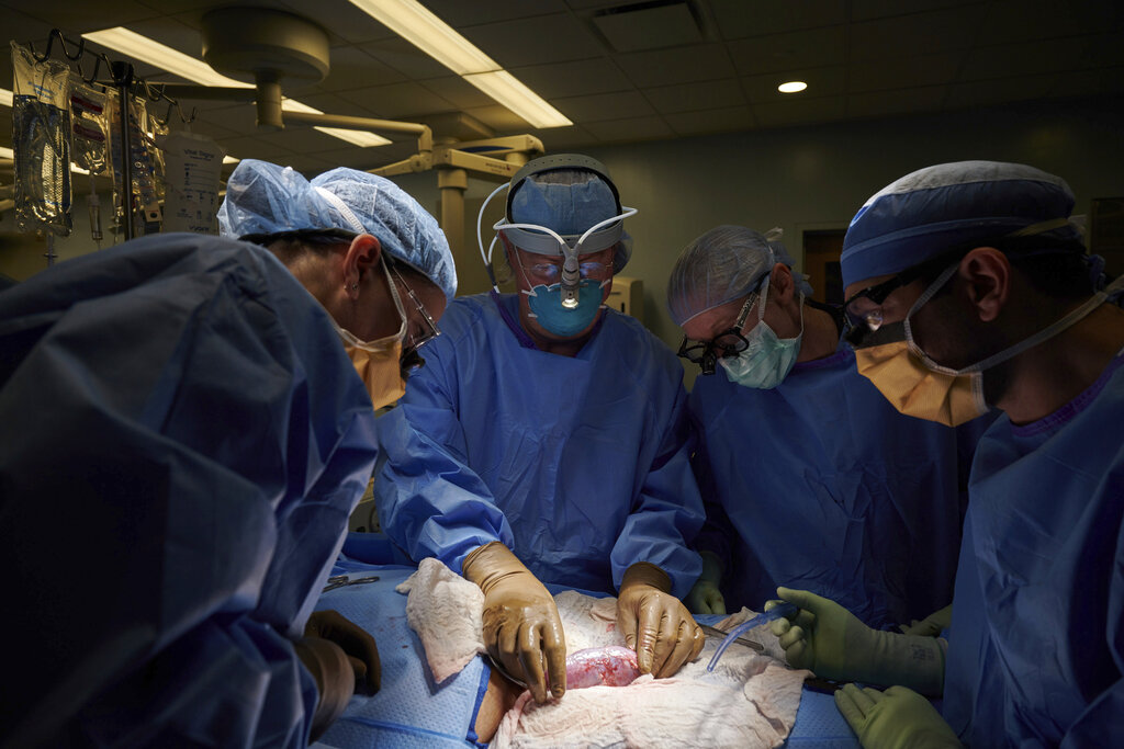 In this September 2021 photo provided by NYU Langone Health, a surgical team at the hospital in New York examines a pig kidney attached to the body of a deceased recipient for any signs of rejection. (Joe Carrotta/NYU Langone Health via AP)