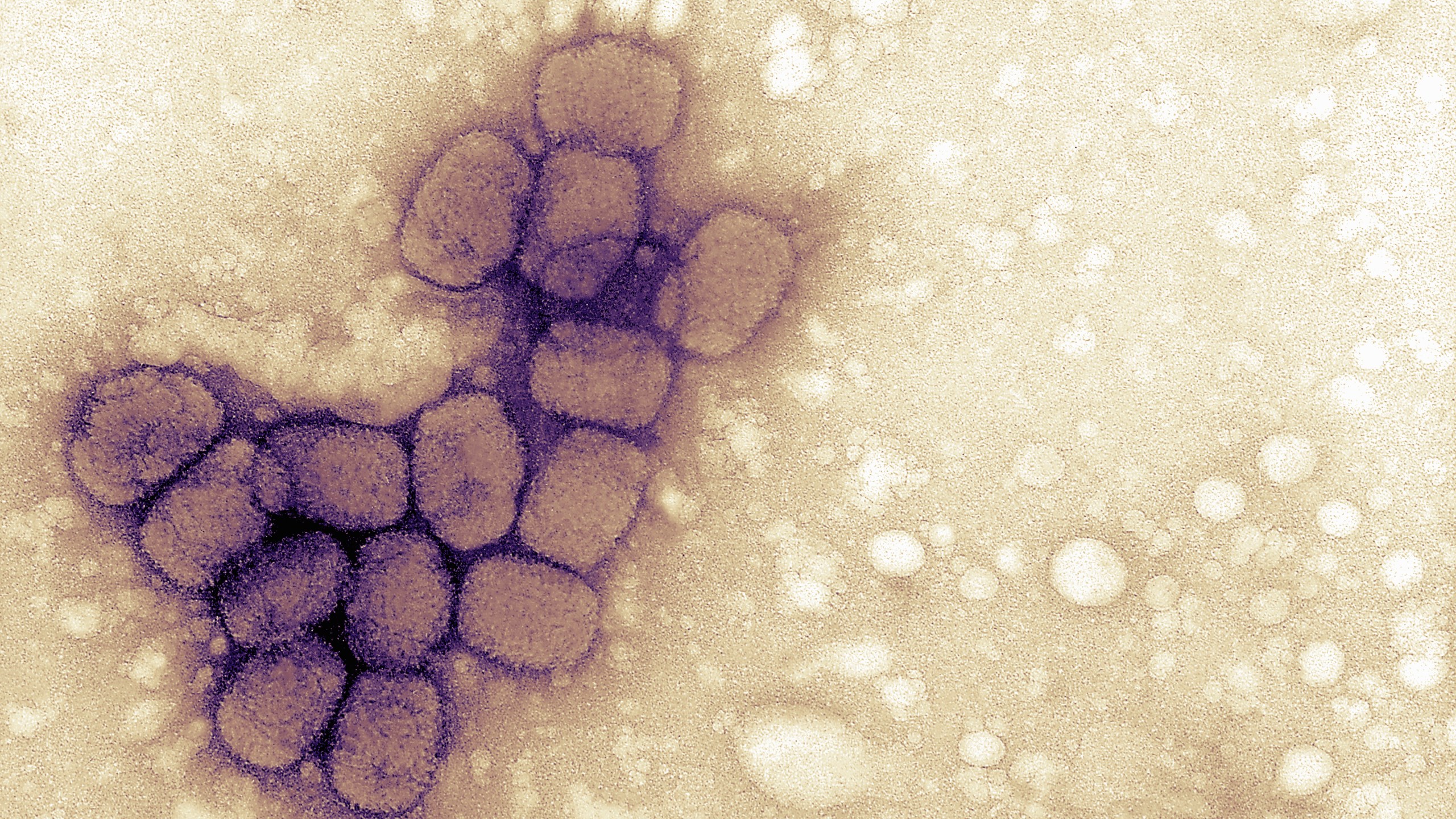 Micrograph of smallpox viruses. Vials labeled "smallpox" were found in a lab near Philadelphia Monday. (Photo: Getty Images)