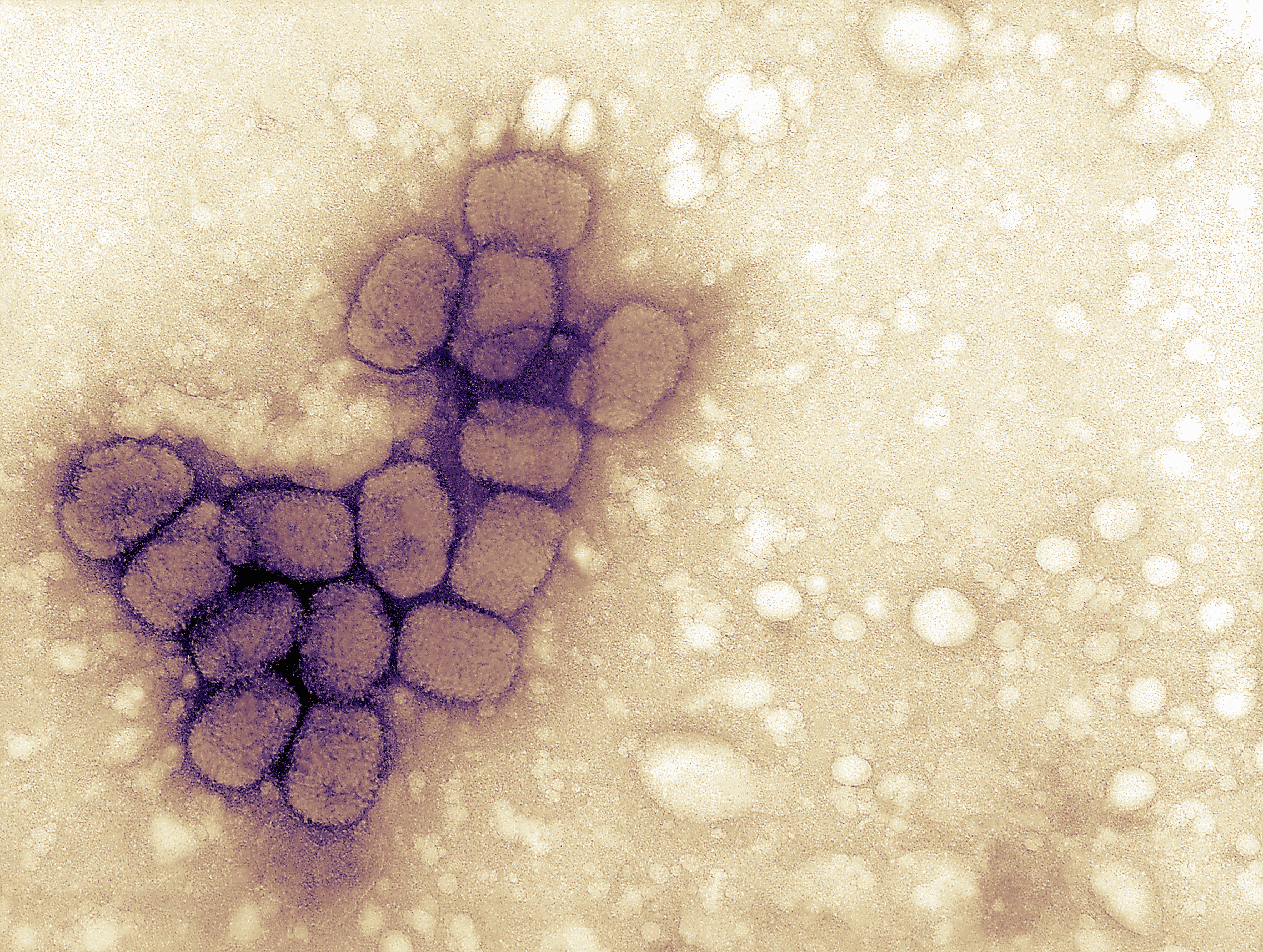 Micrograph of smallpox viruses. Vials labeled "smallpox" were found in a lab near Philadelphia Monday. (Photo: Getty Images)