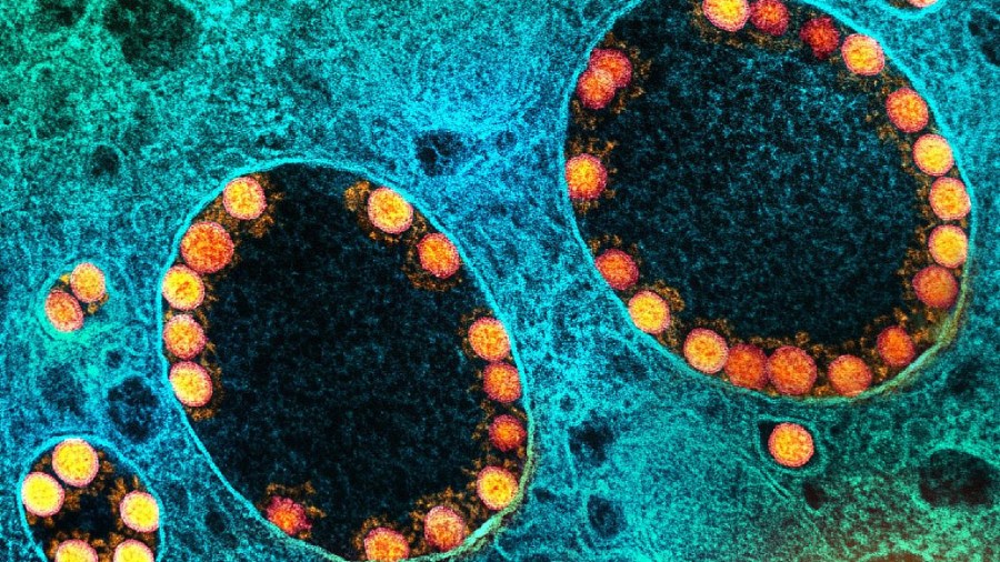 A transmission electron micrograph of SARS-CoV-2 virus particles within endosomes of a heavily infected nasal Olfactory Epithelial Cell.( NIAID)