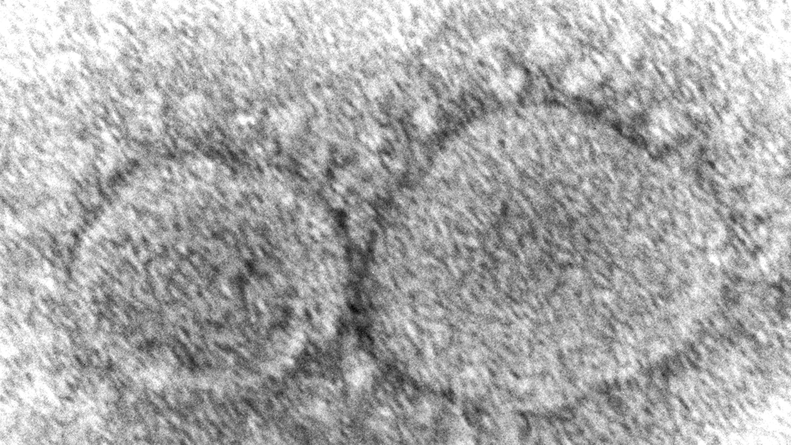 This 2020 electron microscope image made available by the Centers for Disease Control and Prevention shows SARS-CoV-2 virus particles which cause COVID-19. The World Health Organization has appointed an independent scientific panel to advise on whether vaccine shots need reformulating because of omicron or any other mutant. (Hannah A. Bullock, Azaibi Tamin/CDC via AP, File)