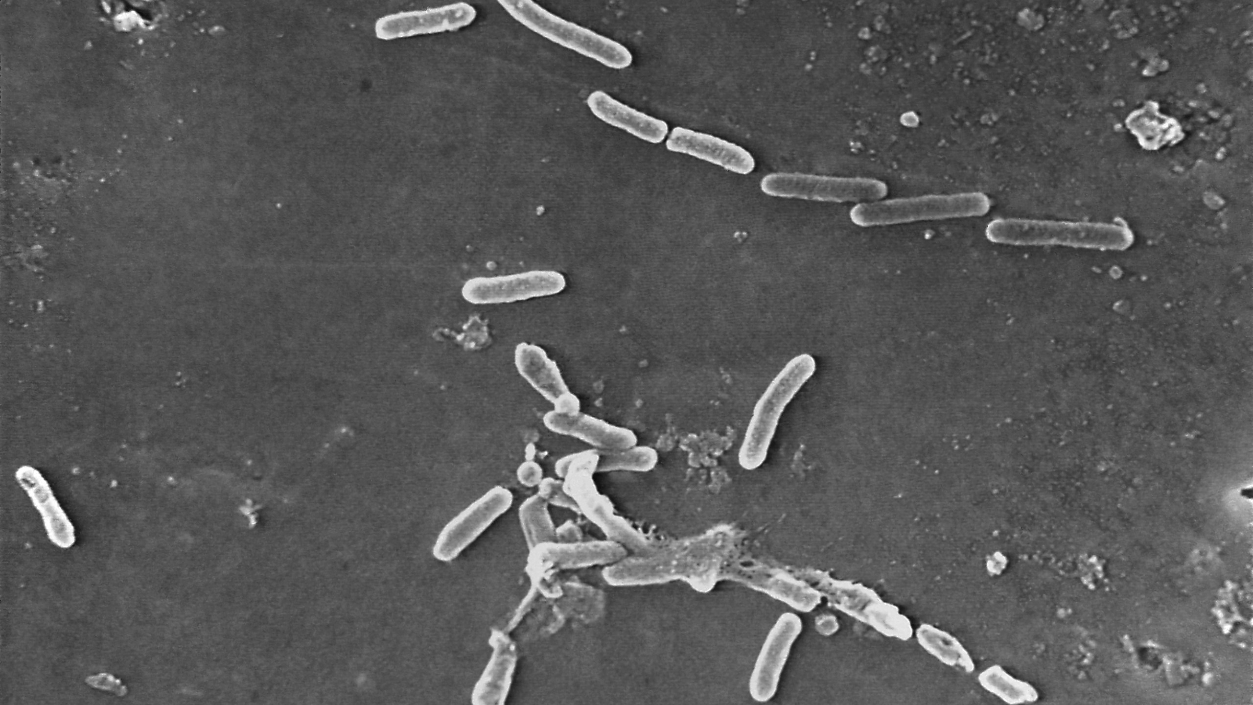 This scanning electron microscope image made available by the Centers for Disease Control and Prevention shows rod-shaped Pseudomonas aeruginosa bacteria. According to a report published Thursday, Jan. 20, 2022, in the medical journal Lancet, antibiotic-resistant germs caused more than 1.2 million deaths globally in one year, according to new research that suggests that so-called “superbugs” have joined the ranks of the world’s leading infectious disease killers. (Janice Haney Carr/CDC via AP)