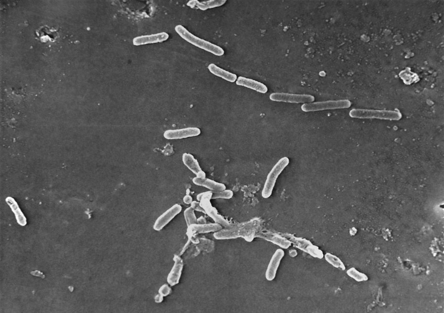 This scanning electron microscope image made available by the Centers for Disease Control and Prevention shows rod-shaped Pseudomonas aeruginosa bacteria. According to a report published Thursday, Jan. 20, 2022, in the medical journal Lancet, antibiotic-resistant germs caused more than 1.2 million deaths globally in one year, according to new research that suggests that so-called “superbugs” have joined the ranks of the world’s leading infectious disease killers. (Janice Haney Carr/CDC via AP)