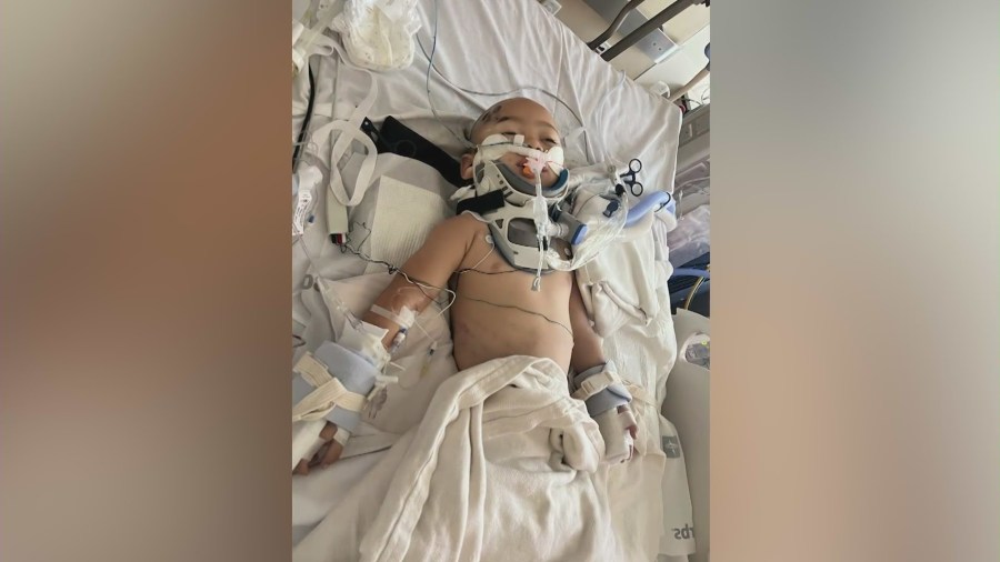 Dominick Zelaya. 3, has undergone surgery after a South L.A. hit-and-run left him severely injured. (LAPD)