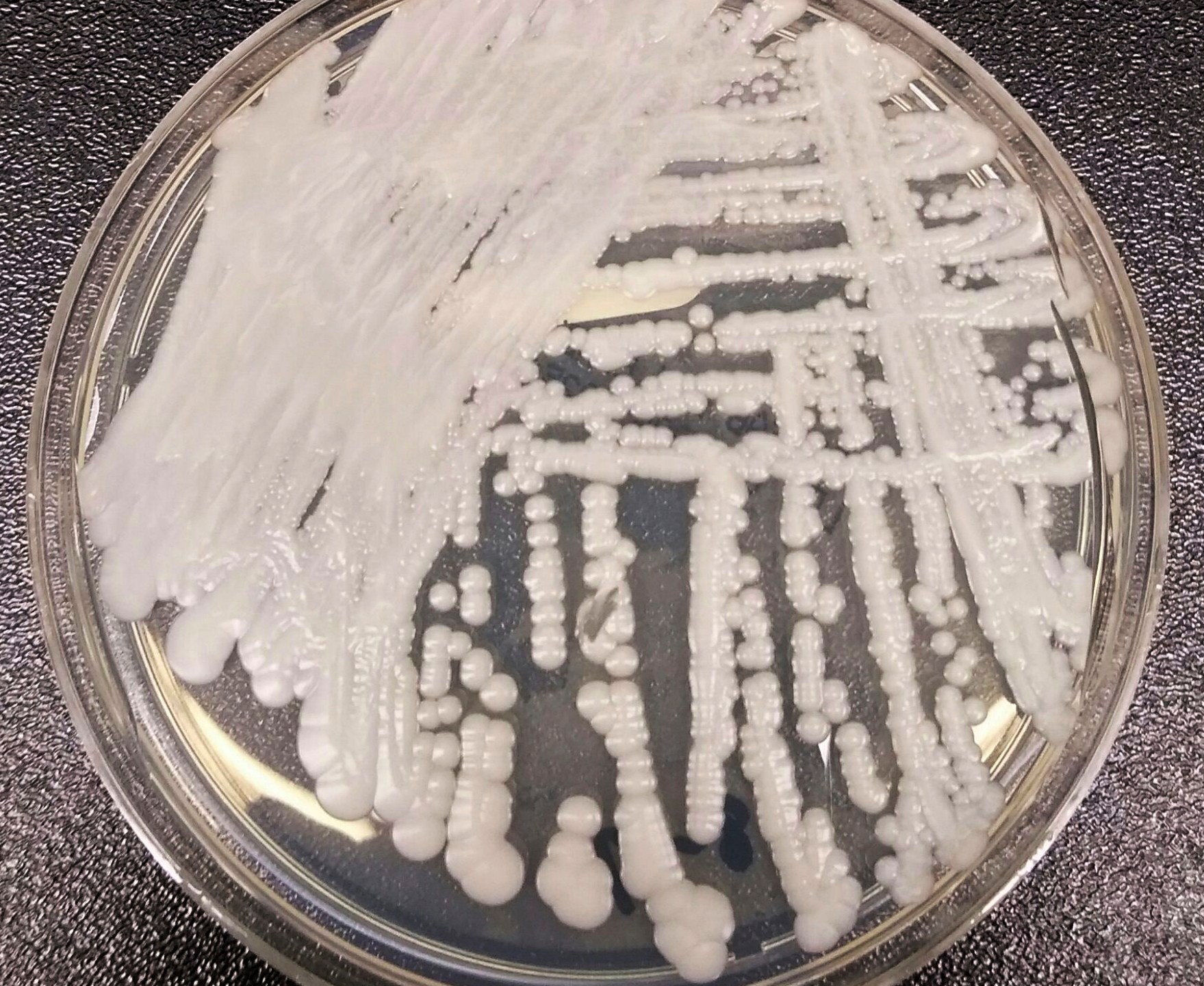 This 2016 photo made available by the Centers for Disease Control and Prevention shows a strain of Candida auris cultured in a petri dish at a CDC laboratory. (Shawn Lockhart/CDC via AP)