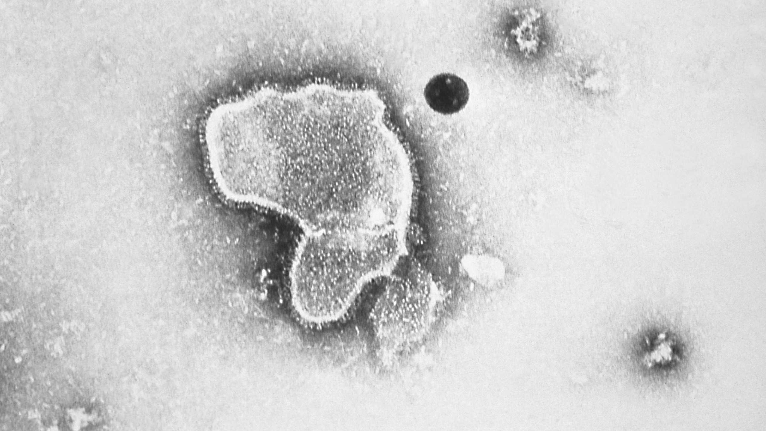 This 1981 photo provided by the Centers for Disease Control and Prevention shows an electron micrograph of Respiratory Syncytial Virus, also known as RSV. (CDC via AP, File)