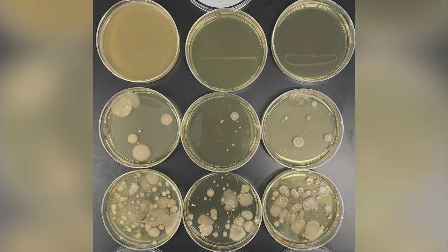 Antibiotic-resistant super bacteria found for the first time in Los Angeles County. (KTLA)