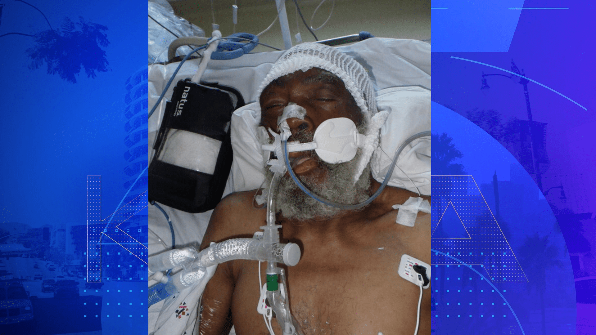 The 70-year-old unidentified patient in a photo from the Los Angeles General Medical Center.