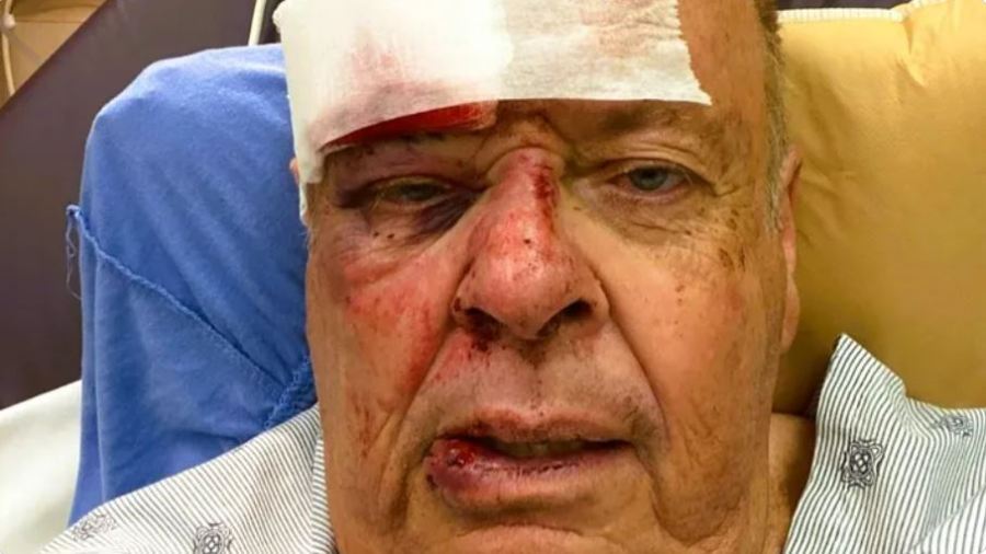 LAPD volunteer "Gary" recovering after a swarm of bees attacked him in Encino on May 15, 2023. (GoFundMe)