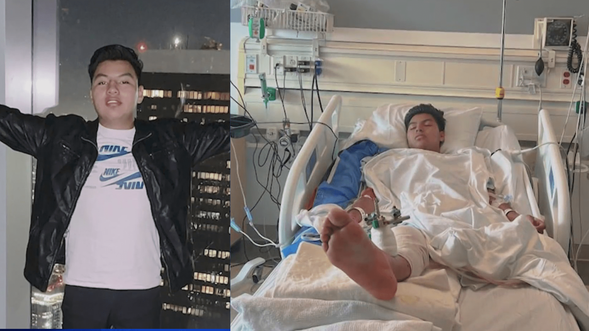 Gelvy Ortiz became an amputee and remains hospitalized after a suspected drunk driver struck him in Santa Monica on June 2, 2023. (Ortiz Family)