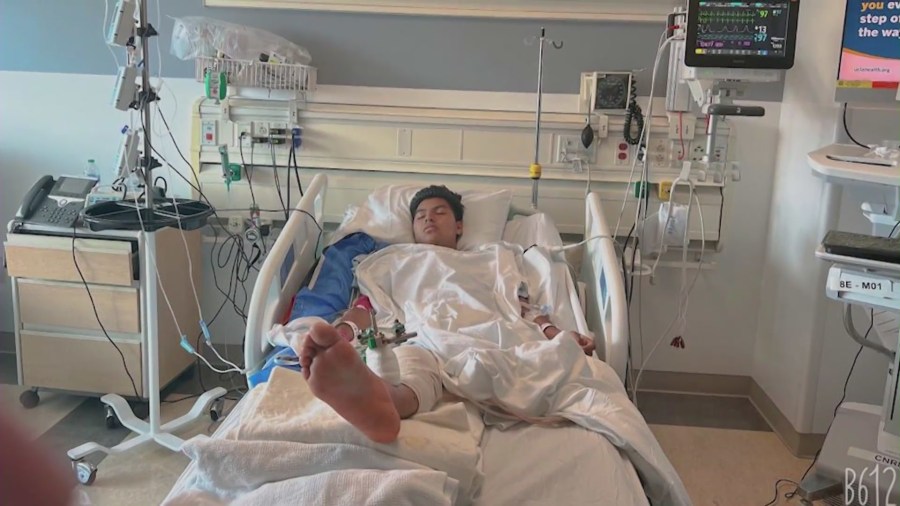 Gelvy Ortiz became an amputee and remains hospitalized after a suspected drunk driver struck him in Santa Monica on June 2, 2023. (Ortiz Family)