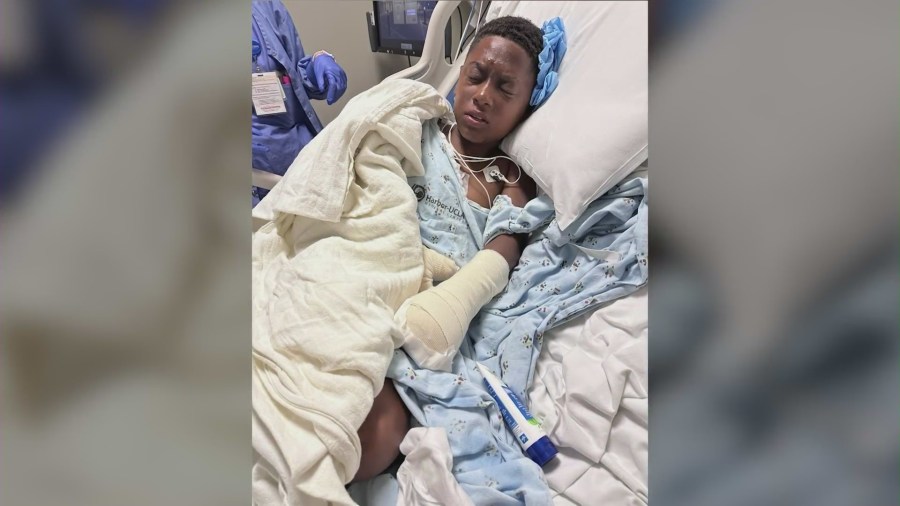 12-year-old Anthony Gibson from South Los Angeles is facing a long recovery after a painful upcoming surgery after an illegal firework went off in his hand in a post-Fourth of July celebration. (Gibson Family)