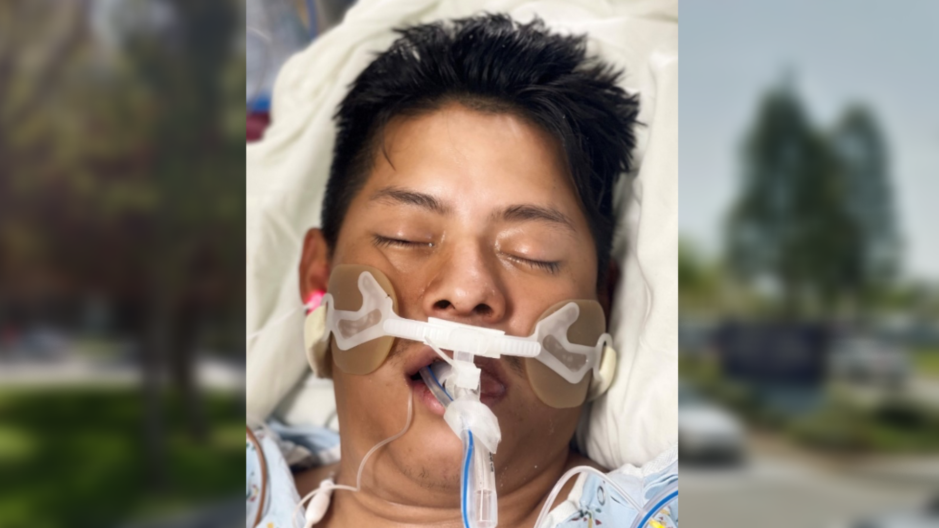 A hospital is asking for the public’s help to identify a patient who was struck by a hit-and-run driver in South Los Angeles on Aug. 25, 2023. (Harbor-UCLA Medical Center)