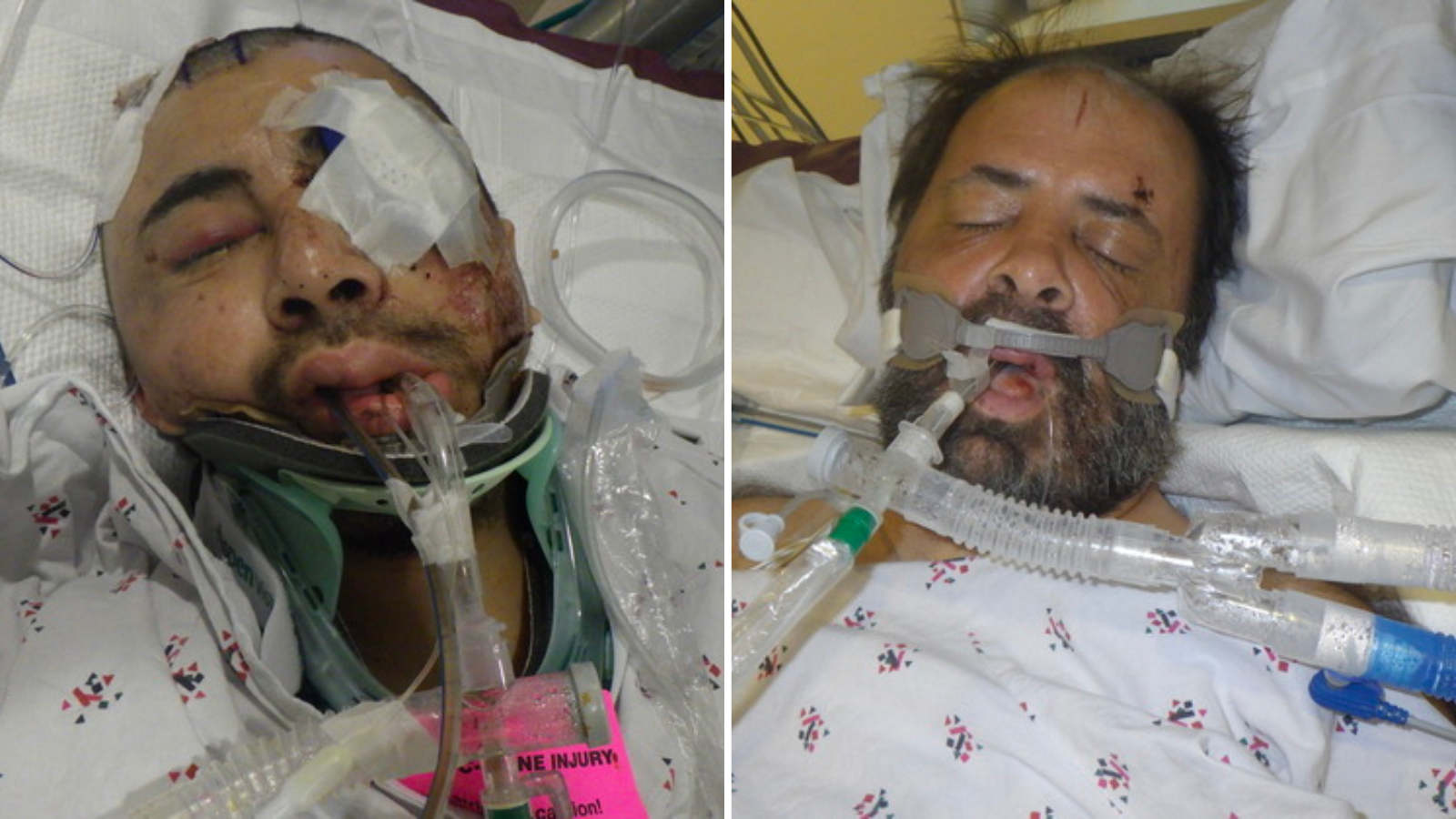 Los Angeles General Medical Center in Boyle Heights is asking for the public's help to identify two patients who have been hospitalized for several days. (Los Angeles County Department of Health Services)